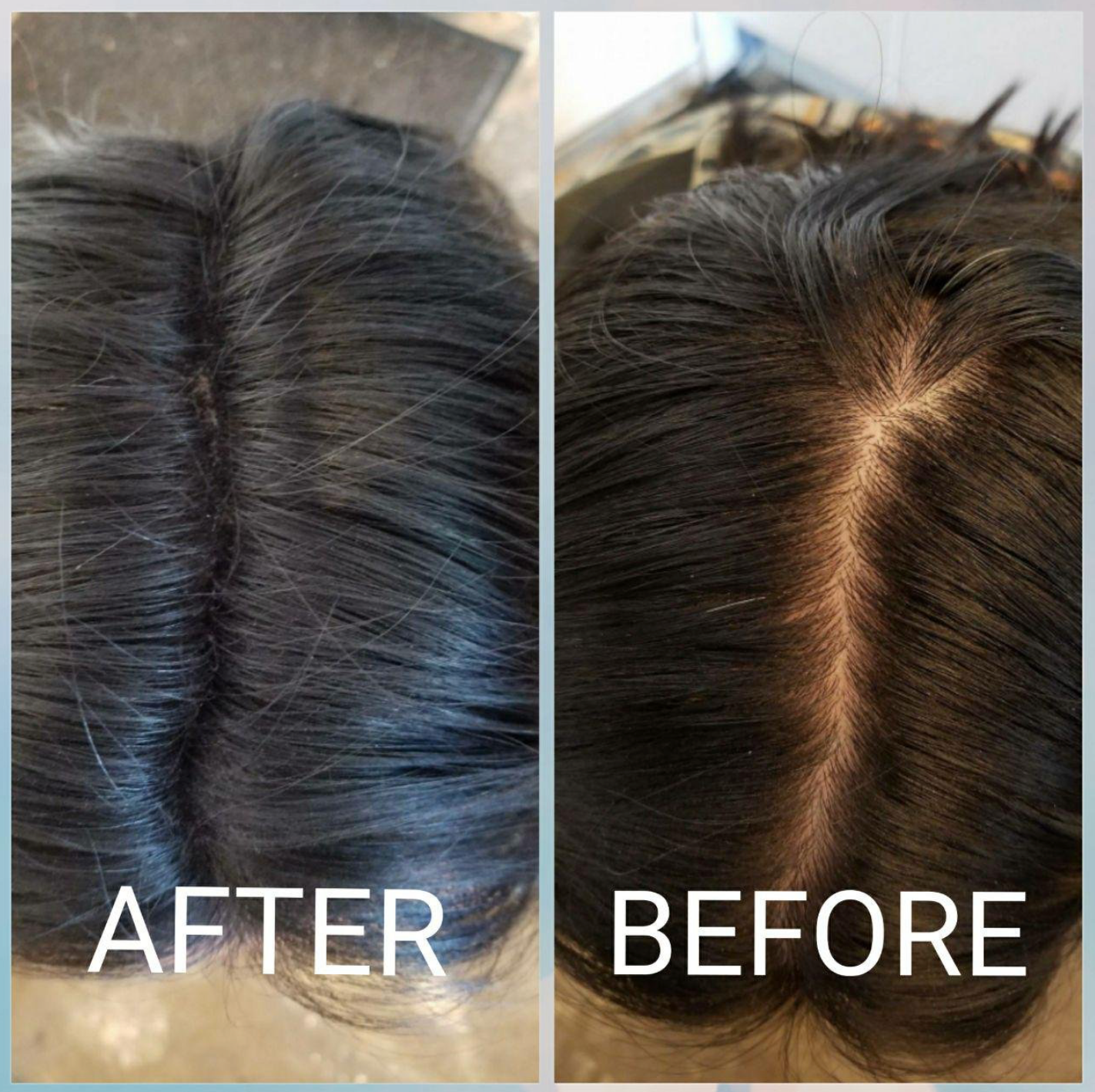 Vora Fibers